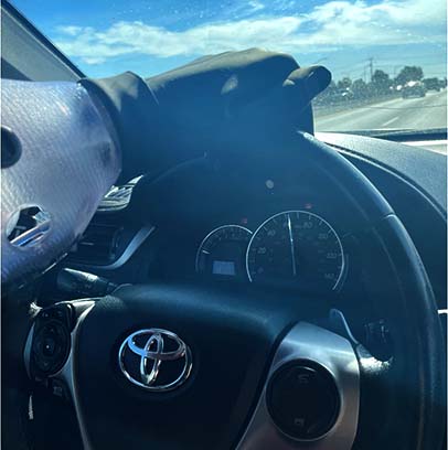 Just about 11 months out from his initial injury, the patient is now driving with his smart prosthetic. There is still much to learn in mastering his prosthetic, but he is making excellent progress.