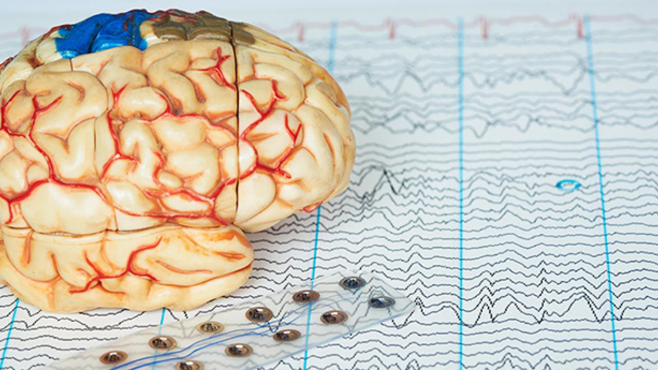 brain-electrodes