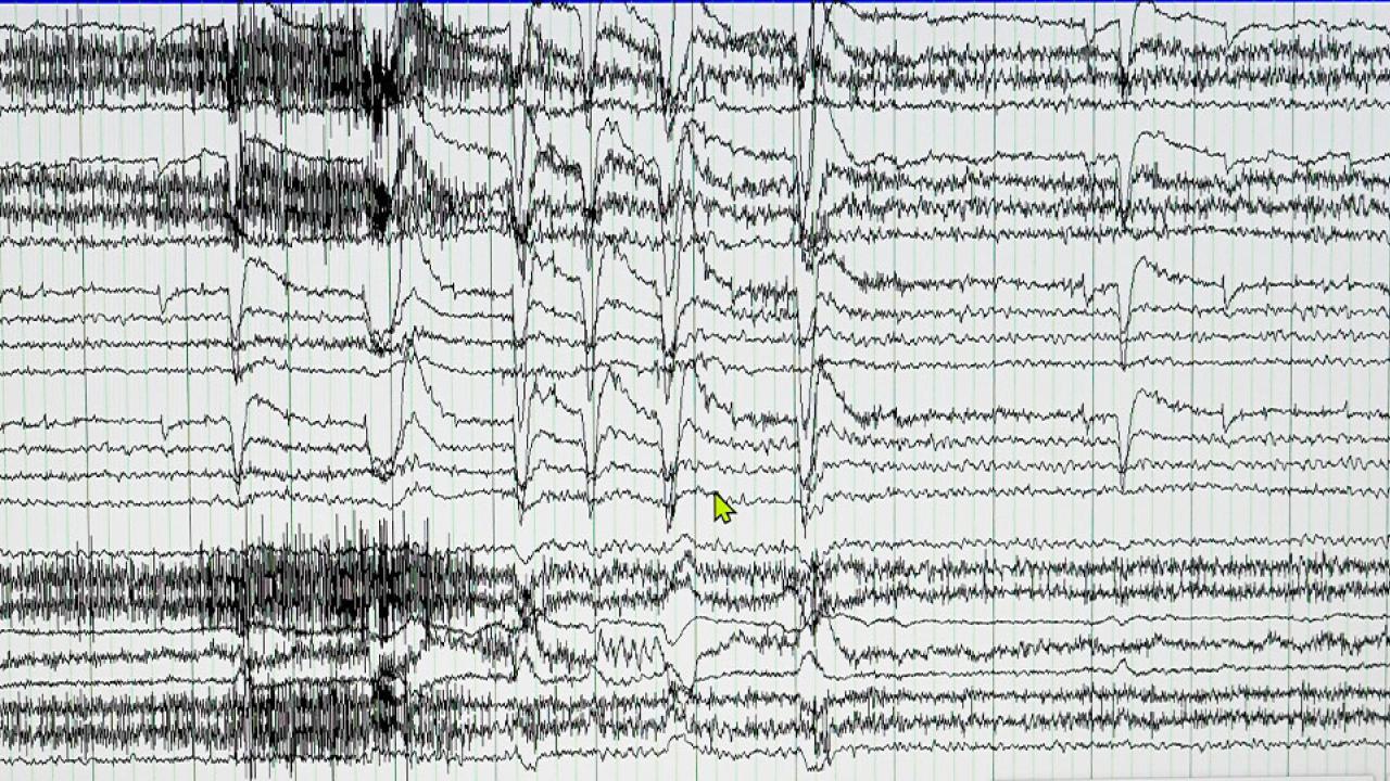 emu-neurodiagnostic