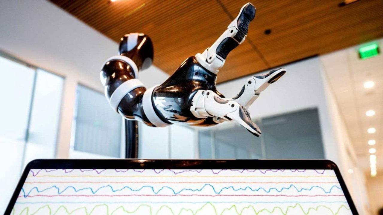 UCSF robotic arm